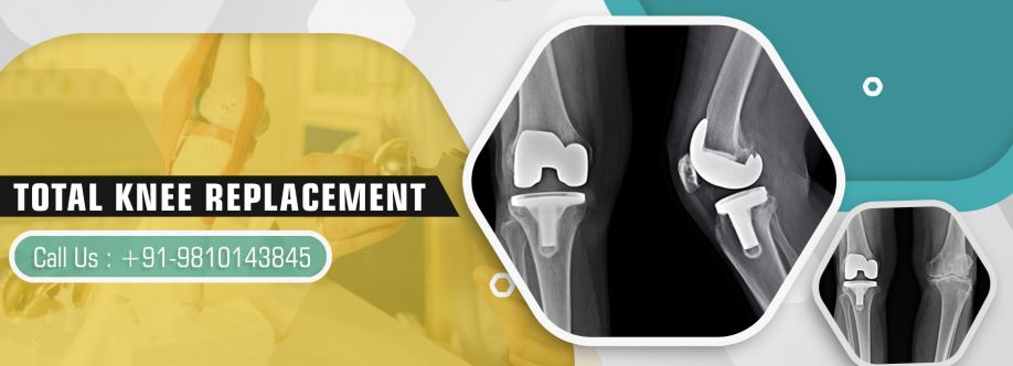 Knee Joint Replacement Cover Image