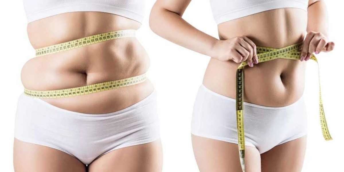 Your Complete Guide to Preparing for a Liposuction Surgery