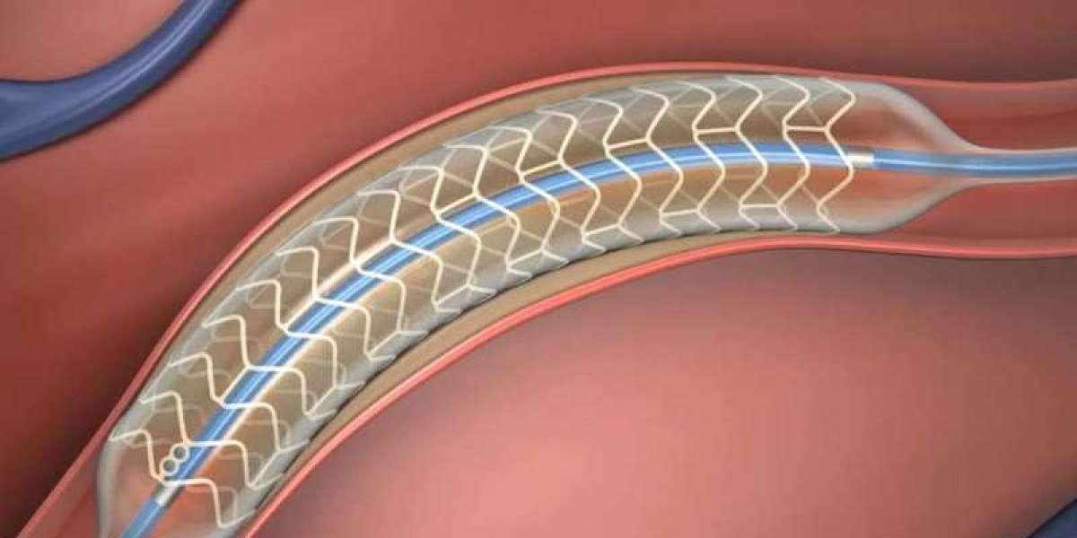 Bioabsorbable Stents Market Trends and Dynamics 2023-2033