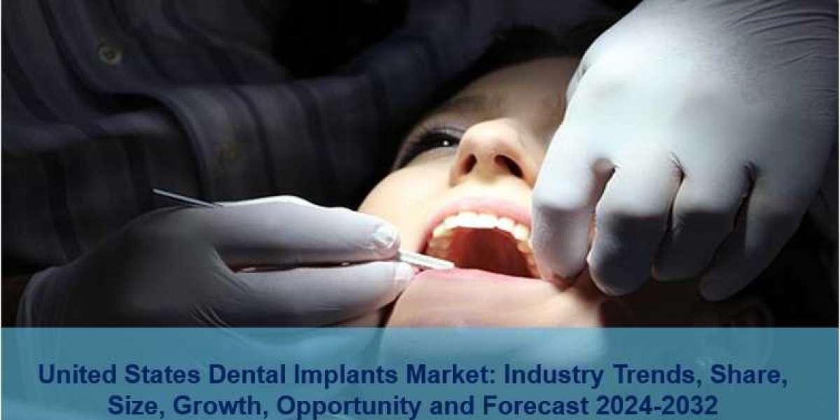 United States Dental Implants Market Share, Size, Trends | Outlook 2024-2032