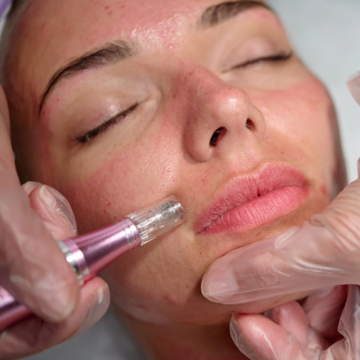 10 Reasons To Get The Best Skincare Treatment From Experts | FACTOFIT