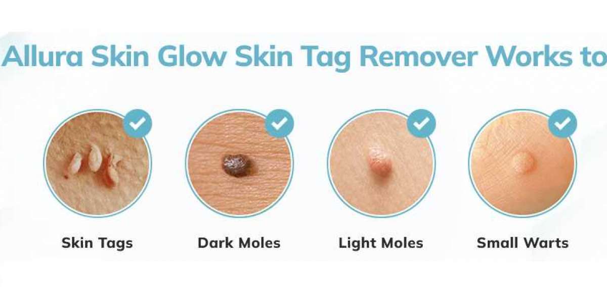 Best Results For Work: Allura Skin Tag Remover Serum Official In USA