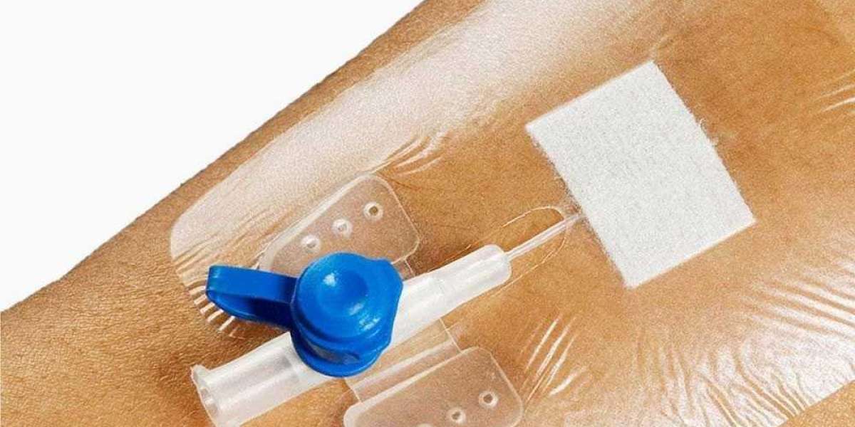 Global IV Dressing Market 2023 - Top Key Players Analysis Report Till 2032