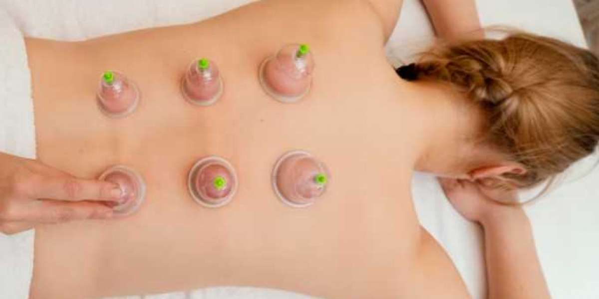 Transform Your Body: Acupuncture for Weight Loss in SG