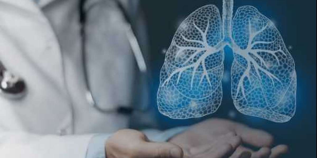 Global Interventional Pulmonology Market Report 2023 to 2032