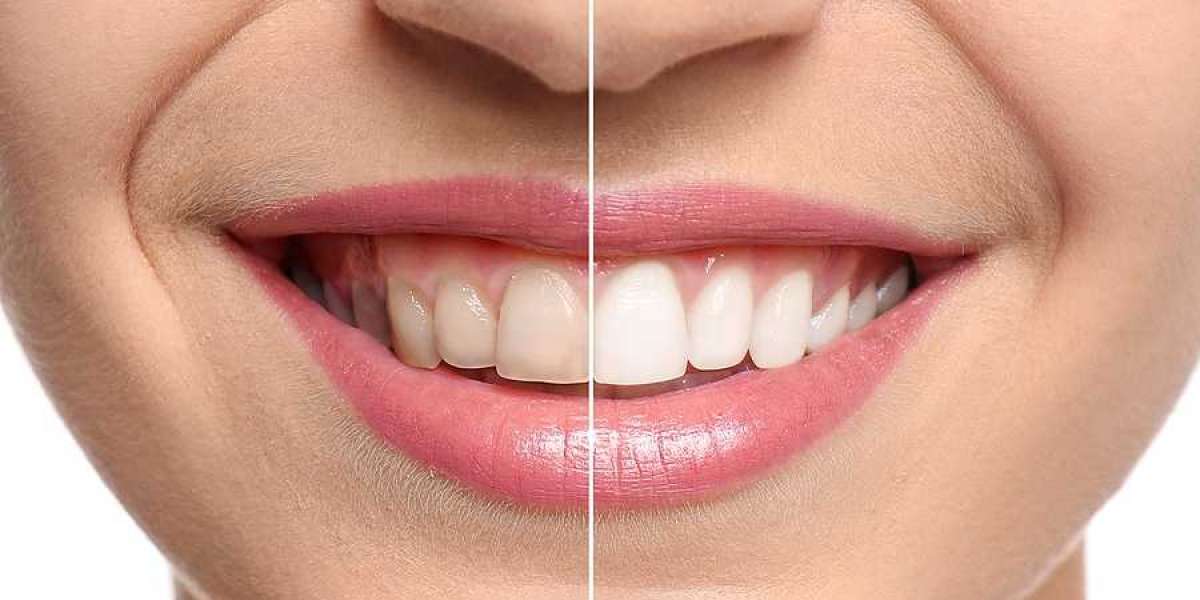 Finding the Best Cosmetic Dentist in Las Vegas: What You Need to Know